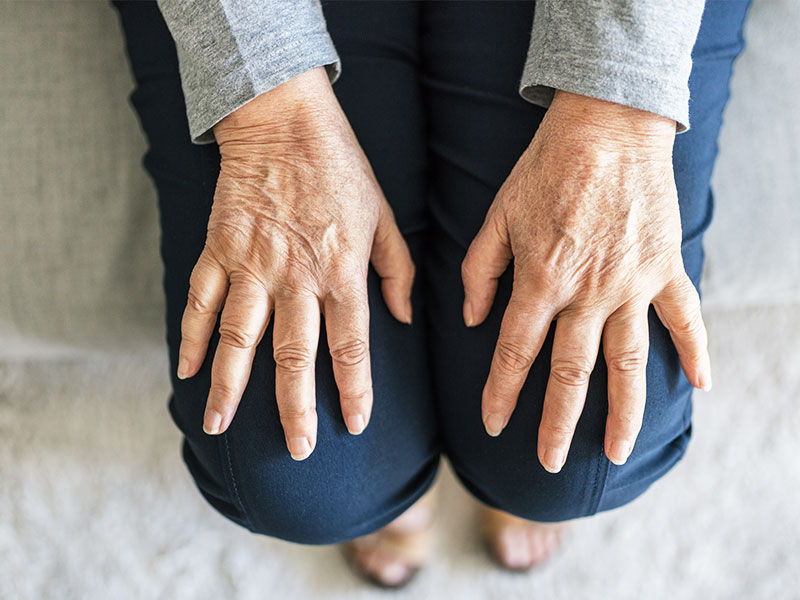 Various forms of Arthritis